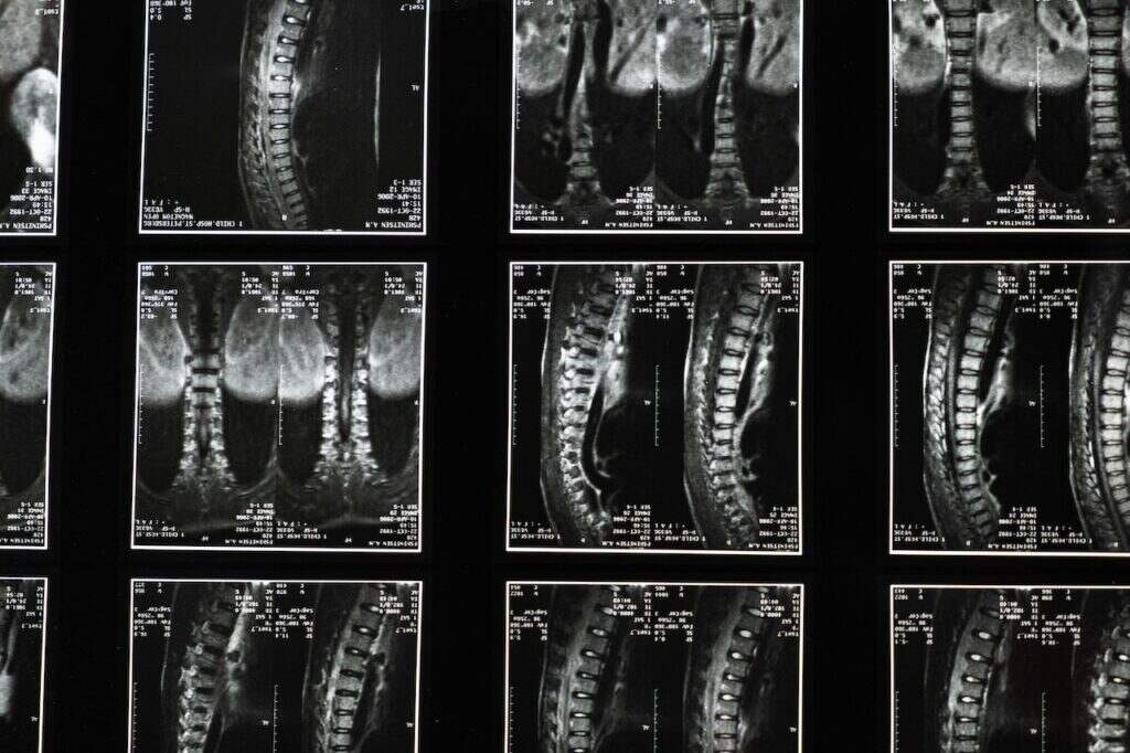 Abogados-de-lesiones-de-medula-espinal-maritimas-en-Houston